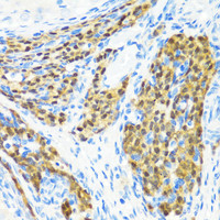 Immunohistochemistry of paraffin-embedded Rat ovary using KMT2E Polyclonal Antibody at dilution of 1:200 (40x lens) .