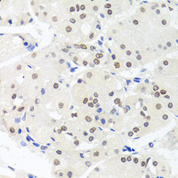 Immunohistochemistry of paraffin-embedded Human stomach using HMGN1 Polyclonal Antibody at dilution of 1:100 (40x lens) .