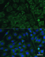 Immunofluorescence analysis of C6 cells using OSM Polyclonal Antibody at dilution of 1:100. Blue: DAPI for nuclear staining.