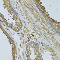 Immunohistochemistry of paraffin-embedded Human prostate using MYLIP Polyclonal Antibody at dilution of 1:100 (40x lens) .