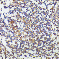 Immunohistochemistry of paraffin-embedded Human colon using CSF3 Polyclonal Antibody at dilution of 1:100 (40x lens) .