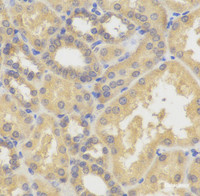 Immunohistochemistry of paraffin-embedded Human kidney using SMYD5 Polyclonal Antibody