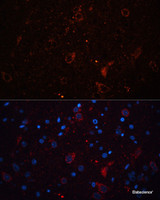 Immunofluorescence analysis of Rat brain using DLG4 Polyclonal Antibody at dilution of 1:100. Blue: DAPI for nuclear staining.