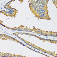 Immunohistochemistry of paraffin-embedded Human prostate using CXCL11 Polyclonal Antibody at dilution of 1:100 (40x lens) .