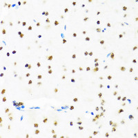 Immunohistochemistry of paraffin-embedded Mouse brain using SET Polyclonal Antibody at dilution of 1:100 (40x lens) .