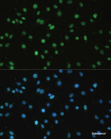 Immunofluorescence analysis of C6 cells using SET Polyclonal Antibody at dilution of 1:100. Blue: DAPI for nuclear staining.