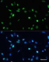 Immunofluorescence analysis of NIH-3T3 cells using SET Polyclonal Antibody at dilution of 1:100. Blue: DAPI for nuclear staining.