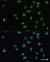 Immunofluorescence analysis of U-2 OS cells using SET Polyclonal Antibody at dilution of 1:100. Blue: DAPI for nuclear staining.