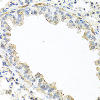 Immunohistochemistry of paraffin-embedded Mouse lung using IL22 Polyclonal Antibody at dilution of 1:100 (40x lens) .