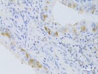 Immunohistochemistry of paraffin-embedded Mouse lung using CYP2C9 Polyclonal Antibody at dilution of 1:100 (40x lens) .