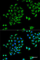 Immunofluorescence analysis of U2OS cells using CYP2C9 Polyclonal Antibody