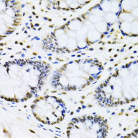 Immunohistochemistry of paraffin-embedded Human colon using CBX8 Polyclonal Antibody at dilution of 1:100 (40x lens) .