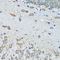 Immunohistochemistry of paraffin-embedded Mouse brain using FDFT1 Polyclonal Antibody at dilution of 1:100 (40x lens) .