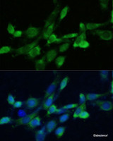 Immunofluorescence analysis of NIH-3T3 cells using FDFT1 Polyclonal Antibody at dilution of 1:100. Blue: DAPI for nuclear staining.
