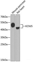 Western blot analysis of extracts of various cell lines using KCNJ5 Polyclonal Antibody at dilution of 1:1000.