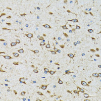 Immunohistochemistry of paraffin-embedded Rat brain using AKTIP Polyclonal Antibody at dilution of 1:100 (40x lens) .