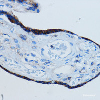 Immunohistochemistry of paraffin-embedded Human placenta using MMP2 Polyclonal Antibody at dilution of 1:100 (40x lens) .