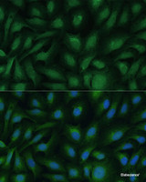 Immunofluorescence analysis of U-2 OS cells using COG2 Polyclonal Antibody at dilution of 1:100 (40x lens) . Blue: DAPI for nuclear staining.