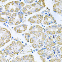 Immunohistochemistry of paraffin-embedded Human stomach using TNFRSF10A Polyclonal Antibody at dilution of 1:100 (40x lens) .