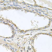 Immunohistochemistry of paraffin-embedded Human prostate using TNFRSF10A Polyclonal Antibody at dilution of 1:100 (40x lens) .