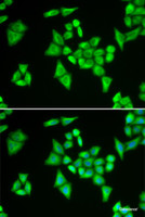 Immunofluorescence analysis of HeLa cells using ADSL Polyclonal Antibody