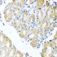 Immunohistochemistry of paraffin-embedded Human stomach using BNIP3L Polyclonal Antibody at dilution of 1:100 (40x lens) .