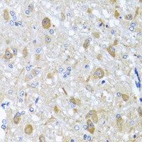 Immunohistochemistry of paraffin-embedded Rat brain using BNIP3L Polyclonal Antibody at dilution of 1:100 (40x lens) .