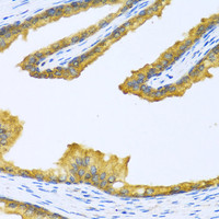 Immunohistochemistry of paraffin-embedded Human prostate using BTD Polyclonal Antibody at dilution of 1:100 (40x lens) .