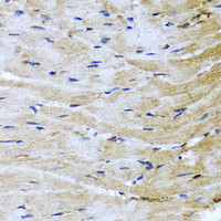 Immunohistochemistry of paraffin-embedded Mouse heart using M6PR Polyclonal Antibody at dilution of 1:100 (40x lens) .