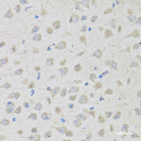 Immunohistochemistry of paraffin-embedded Mouse brain using PENK Polyclonal Antibody at dilution of 1:100 (40x lens) .