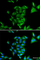 Immunofluorescence analysis of U2OS cells using PHYH Polyclonal Antibody