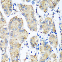 Immunohistochemistry of paraffin-embedded Human stomach using PLEK Polyclonal Antibody at dilution of 1:200 (40x lens) .
