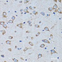 Immunohistochemistry of paraffin-embedded Rat brain using RARS Polyclonal Antibody at dilution of 1:100 (40x lens) .