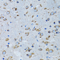 Immunohistochemistry of paraffin-embedded Mouse brain using RARS Polyclonal Antibody at dilution of 1:100 (40x lens) .