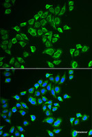 Immunofluorescence analysis of HeLa cells using TAC3 Polyclonal Antibody