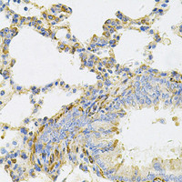 Immunohistochemistry of paraffin-embedded Rat lung using UBE2B Polyclonal Antibody at dilution of 1:100 (40x lens) .