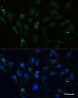 Immunofluorescence analysis of C6 cells using ZWINT Polyclonal Antibody at dilution of 1:100 (40x lens) . Blue: DAPI for nuclear staining.