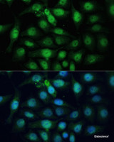 Immunofluorescence analysis of HeLa cells using ZWINT Polyclonal Antibody at dilution of 1:100 (40x lens) . Blue: DAPI for nuclear staining.