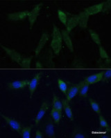 Immunofluorescence analysis of NIH-3T3 cells using ZWINT Polyclonal Antibody at dilution of 1:100 (40x lens) . Blue: DAPI for nuclear staining.