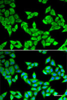 Immunofluorescence analysis of U2OS cells using CIAPIN1 Polyclonal Antibody