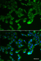Immunofluorescence analysis of HeLa cells using C1R Polyclonal Antibody