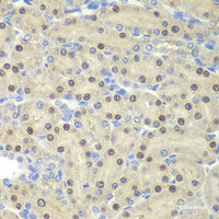 Immunohistochemistry of paraffin-embedded Rat kidney using ELF3 Polyclonal Antibody at dilution of 1:200 (40x lens) .