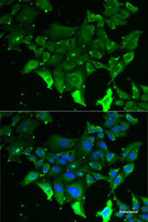 Immunofluorescence analysis of MCF7 cells using GRK6 Polyclonal Antibody