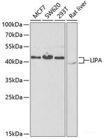 Western blot analysis of extracts of various cell lines using LIPA Polyclonal Antibody at dilution of 1:1000.