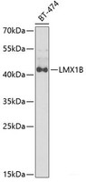 Western blot analysis of extracts of BT-474 cells using LMX1B Polyclonal Antibody at dilution of 1:1000.