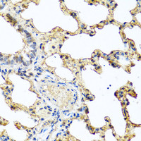 Immunohistochemistry of paraffin-embedded Rat lung using PIP Polyclonal Antibody at dilution of 1:100 (40x lens) .