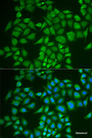 Immunofluorescence analysis of U2OS cells using PNOC Polyclonal Antibody