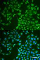 Immunofluorescence analysis of U2OS cells using PNLIP Polyclonal Antibody
