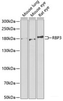 Western blot analysis of extracts of various cell lines using RBP3 Polyclonal Antibody at dilution of 1:1000.