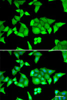 Immunofluorescence analysis of U2OS cells using TRIM27 Polyclonal Antibody